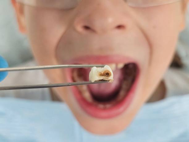 Best Pediatric Emergency Dentist in Cleona, PA